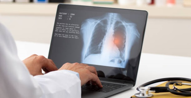 best pulmonologist in panchkula
